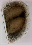 Daphnia_ephippia